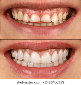 mm美女1314免费视频 mm美女1314免费视频